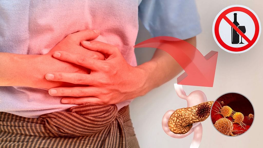 Haimatulehdus ei vaadi kehittyäkseen bakteeri- tai virustartuntaa. Yleisimmät aiheuttajat ovat alkoholi ja sappikivet.