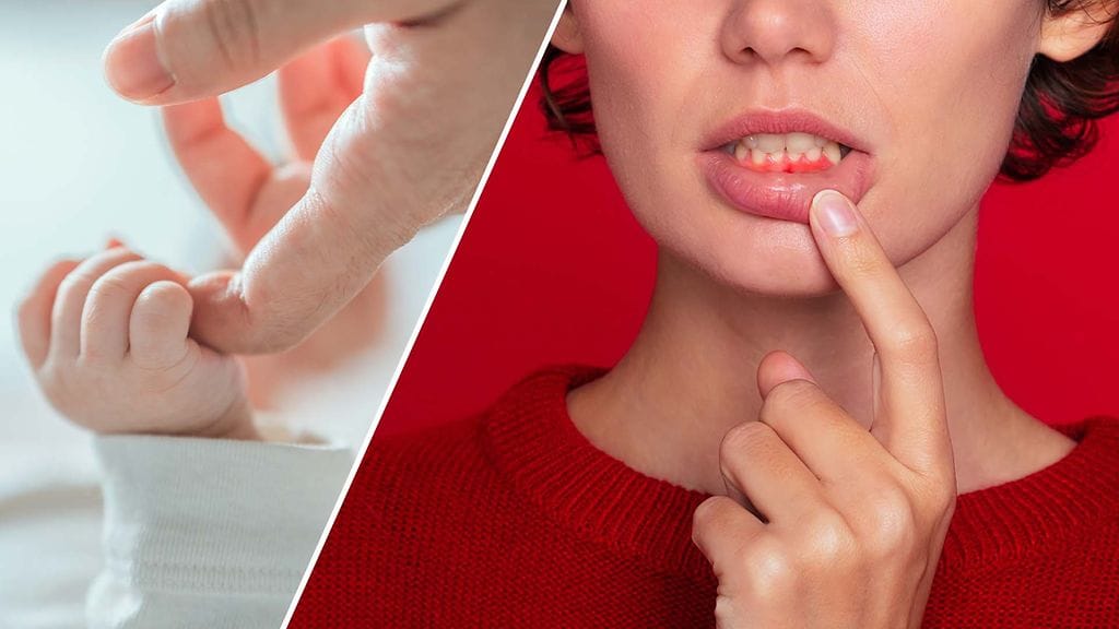 Raskauden aikana syljen koostumus ja happamuus muuttuvat, millä on vaikutuksia hampaiden ja ikenien terveyteen.