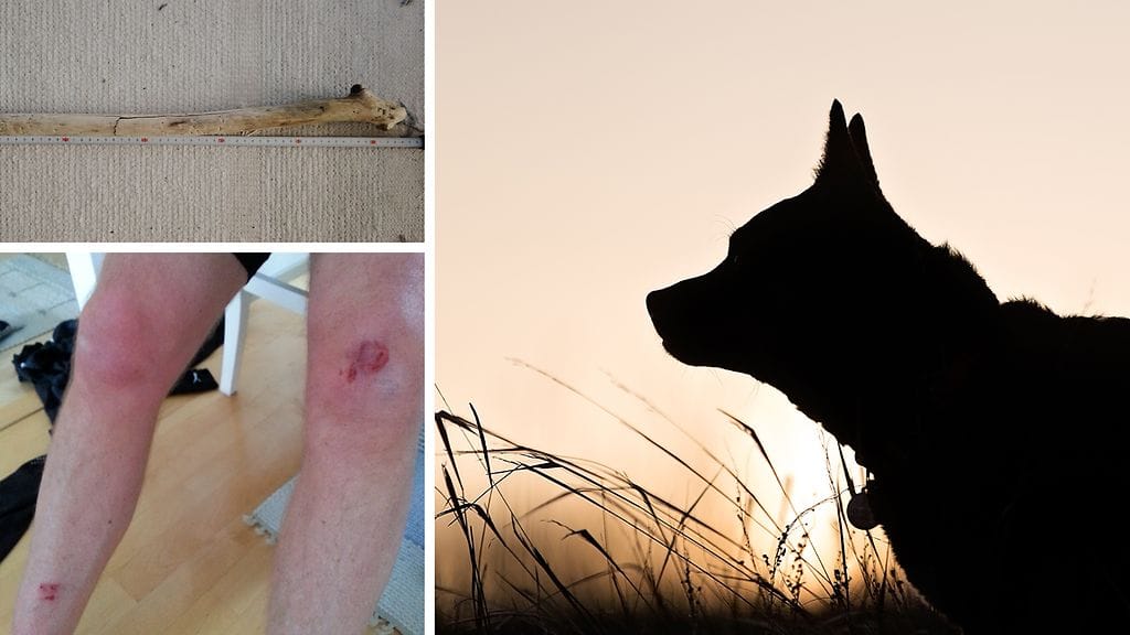 Matti esittelee vammoja, joiden hän kertoo syntyneen koiran hyökättyä hänen kimppuunsa.