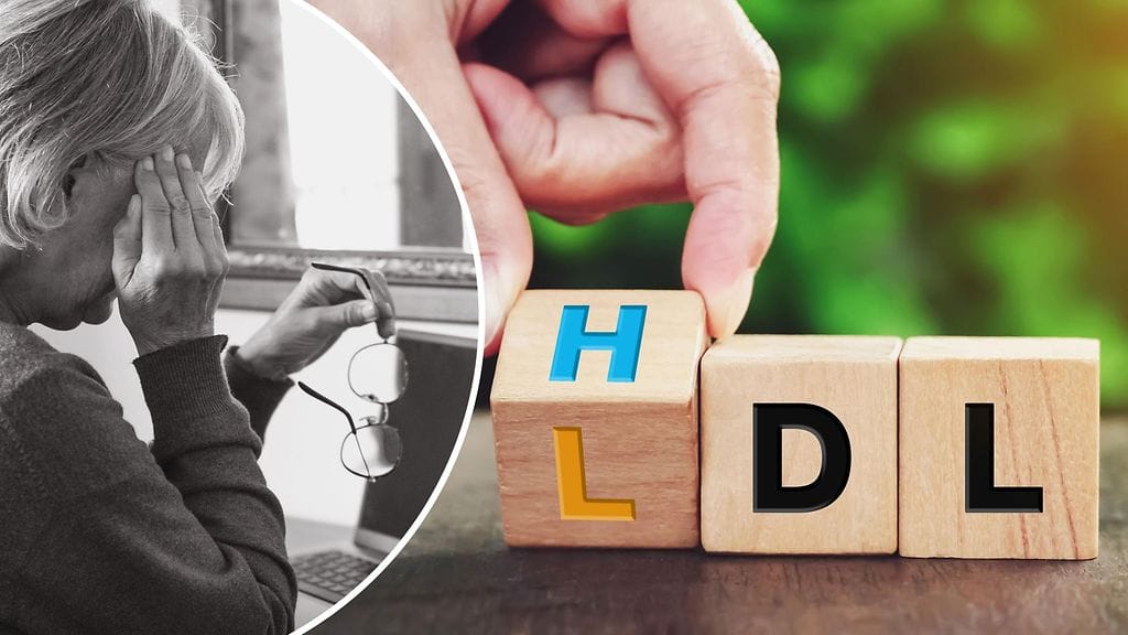 Hyvän kolesterolin koko näytti tutkimuksessa liittyvän Alzheimer-riskiin.