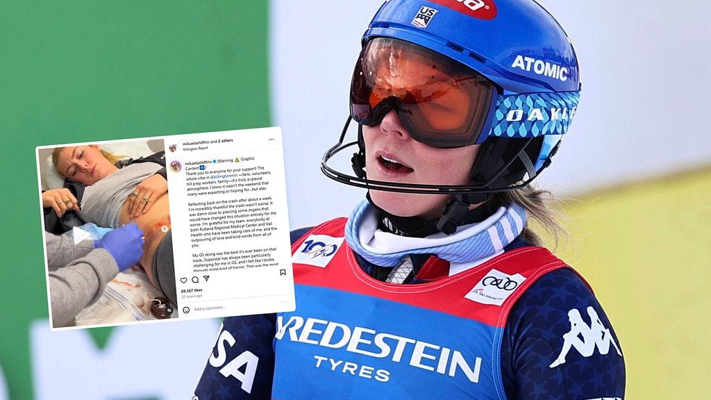 Mikaela Shiffrin loukkaantui viime viikonloppuna maailmancupissa.