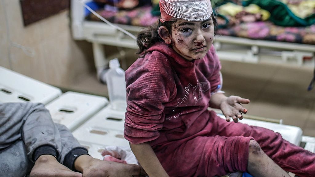 Pakolaisten väliaikaissuojaan osuneessa iskussa loukkaantunut lapsi istui sairaalasängyllä Deir al-Balahissa torstaina.