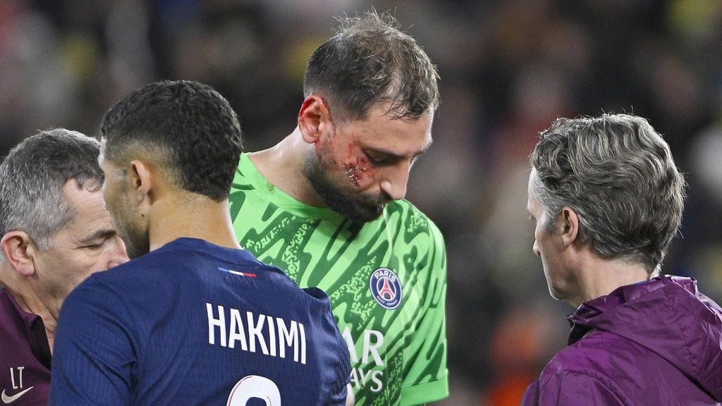 Gianluigi Donnarumma sai rujon iskun päin kasvoja.