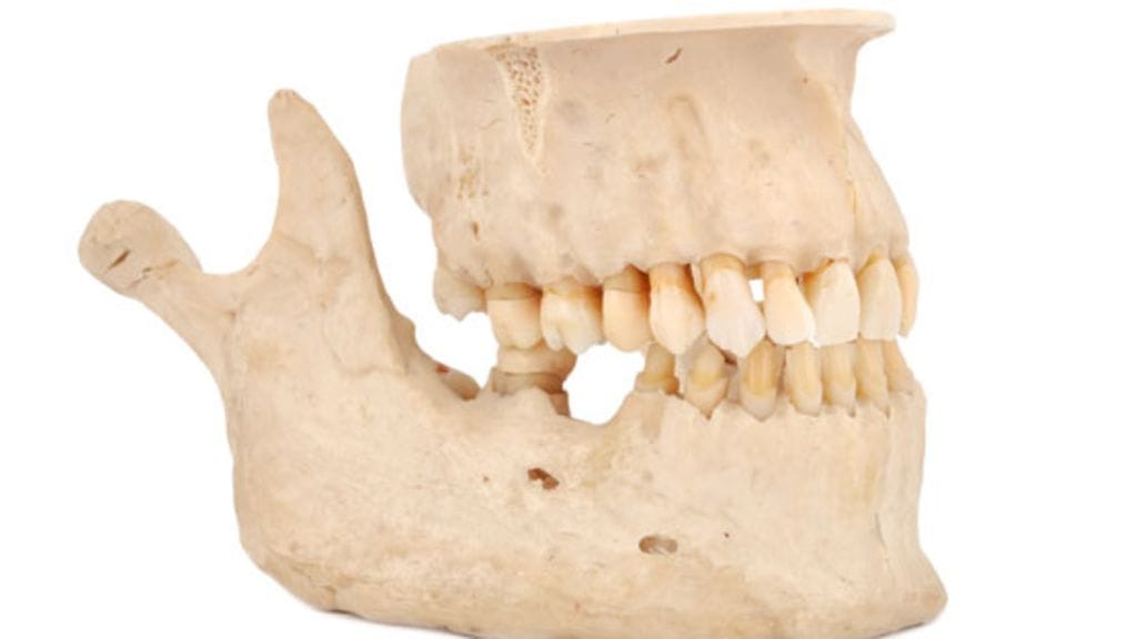Entisaikaan ihmisen hampaat mahtuivat hyvin leukoihin. Kuvituskuva.