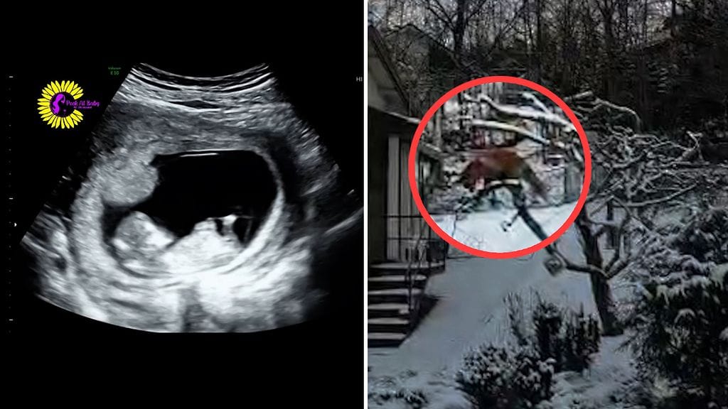 Ultraäänikuvassa näkyi vauvan hytkyminen äidin nauraessa. Kristan Danielsson kuvasi ketun puussa.