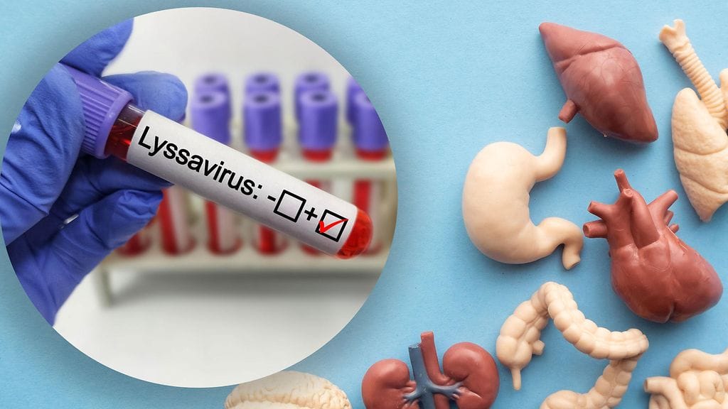 Vesikauhua aiheuttaa lyssavirus.