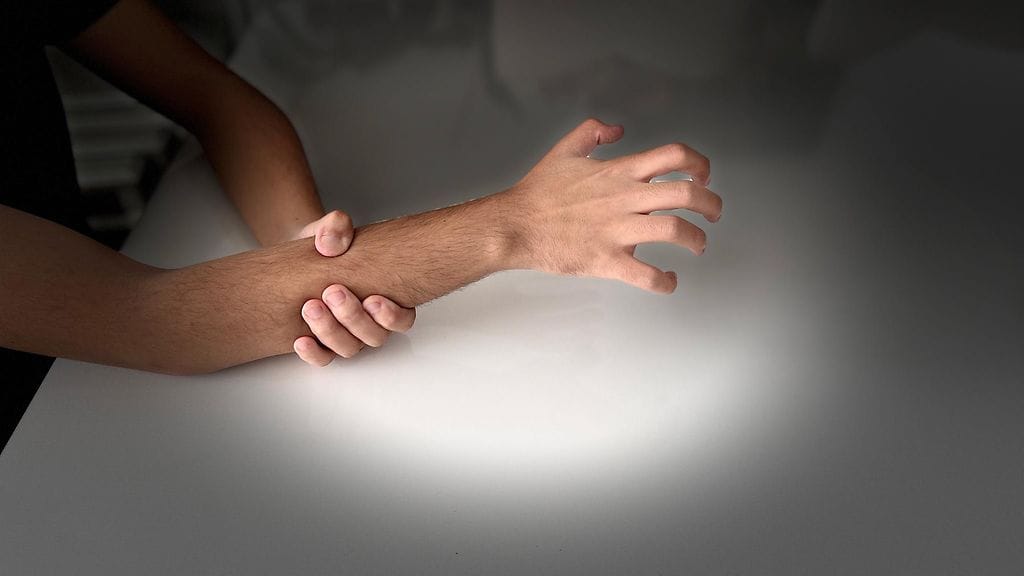 Vieraan käden oireyhtymässä henkilö ei pysty hallitsemaan kätensä toimintaa.