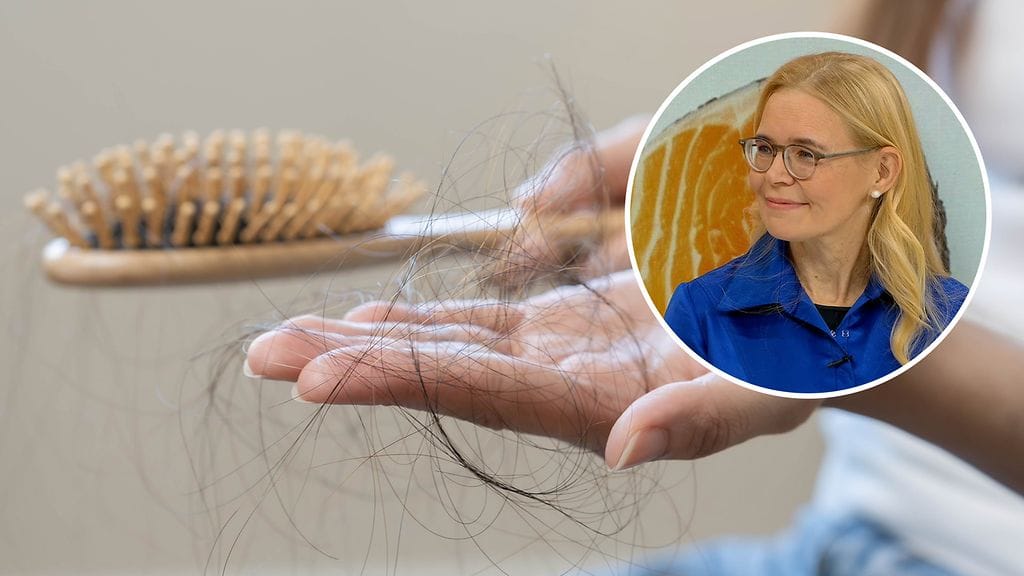 Nopea laihtuminen johtaa herkemmin energiavajeeseen ja ravintoaineiden puutokseen, mikä voi johtaa hiustupen lamautumiseen, Kirsi Pietiläinen kertoo.