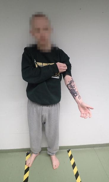 Tatuointipuukotus epäilty blurrattu