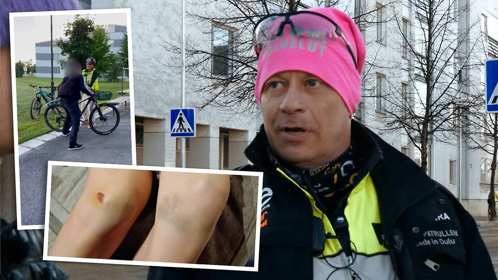 Mies näyttää kuvia vammoista, jotka ovat tulleet siitä, että häntä on hakattu kettingillä.