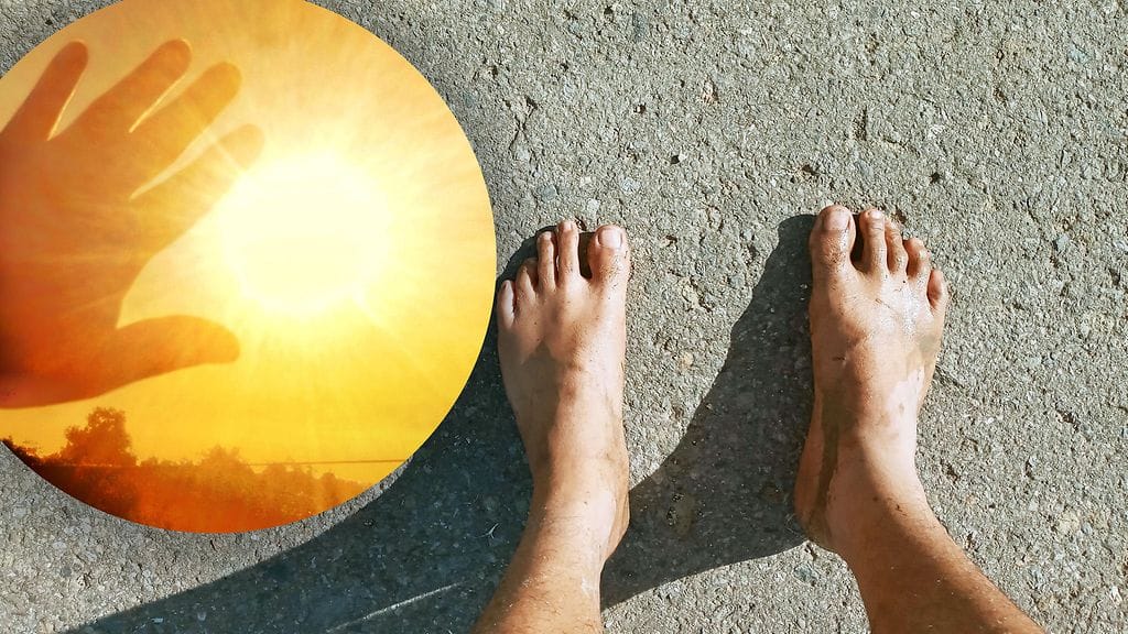 56-vuotiaan miehen jalat paloivat pahoin asfaltilla. Kuvituskuva.