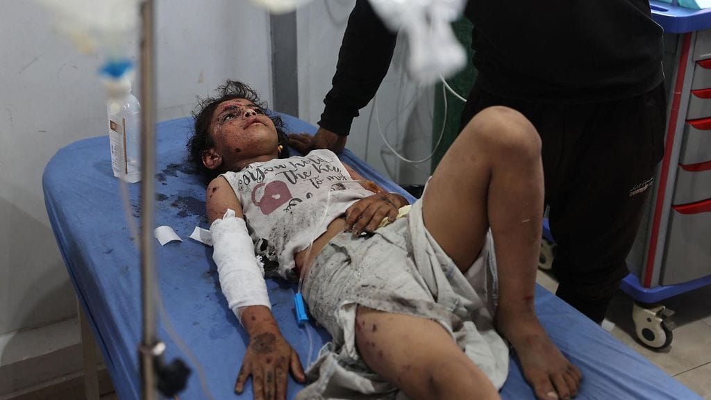 Haavoittunutta tyttöä hoidettiin Al-Awdan sairaalassa Nuseiratin pakolaisleirillä keskisessä Gazassa kouluun osuneen Israelin ilmaiskun jälkeen 19.5. Kolme saman perheen jäsentä kuoli Nuseiratin leirillä ilmaiskussa heidän telttaansa.