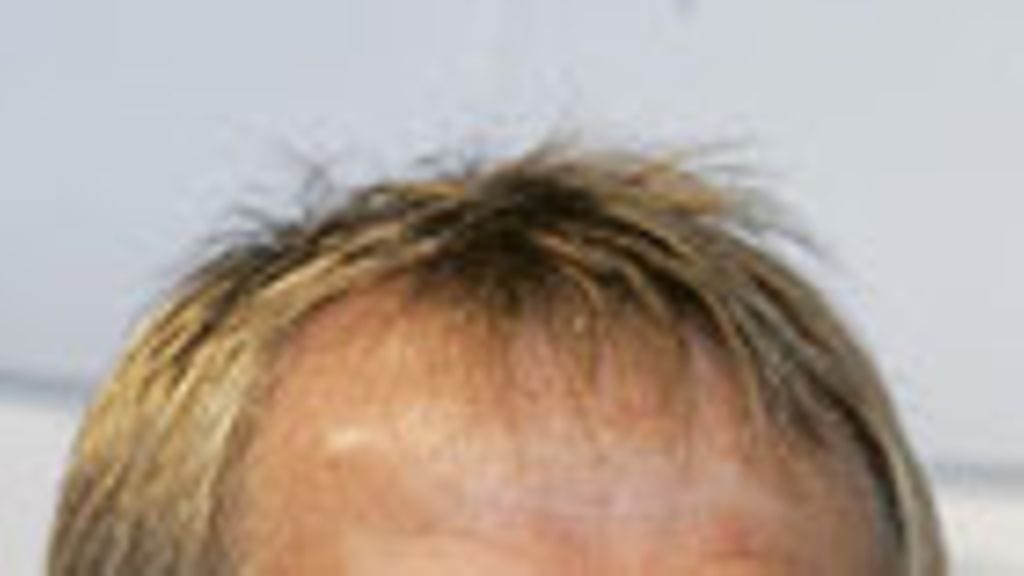 Jürgen Klinsmann, kuva: Christof Koepsel/Getty Images
