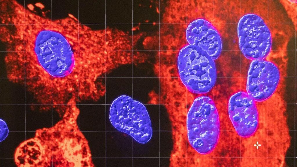 WHO kuvaa Nimbus-muunnoksen seurantaa "ehdottoman tärkeäksi".