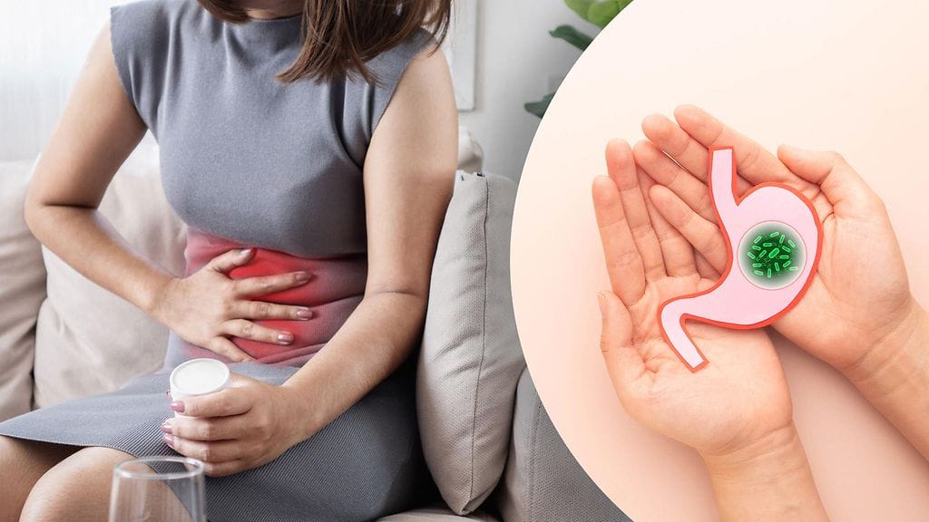 Helikobakteerin aiheuttama mahan limakalvon tulehdus on selvä mahasyövän riskitekijä.