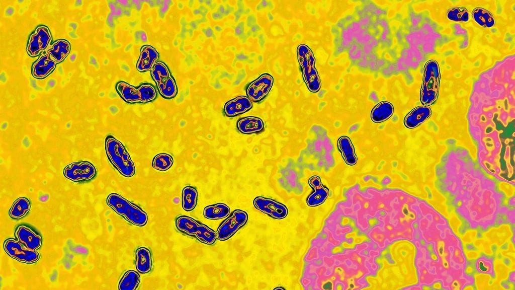 Yersinia pestis -bakteeri voi aiheuttaa kolmea erilaista tautia: Paise-, keuhko- ja veriruttoa.