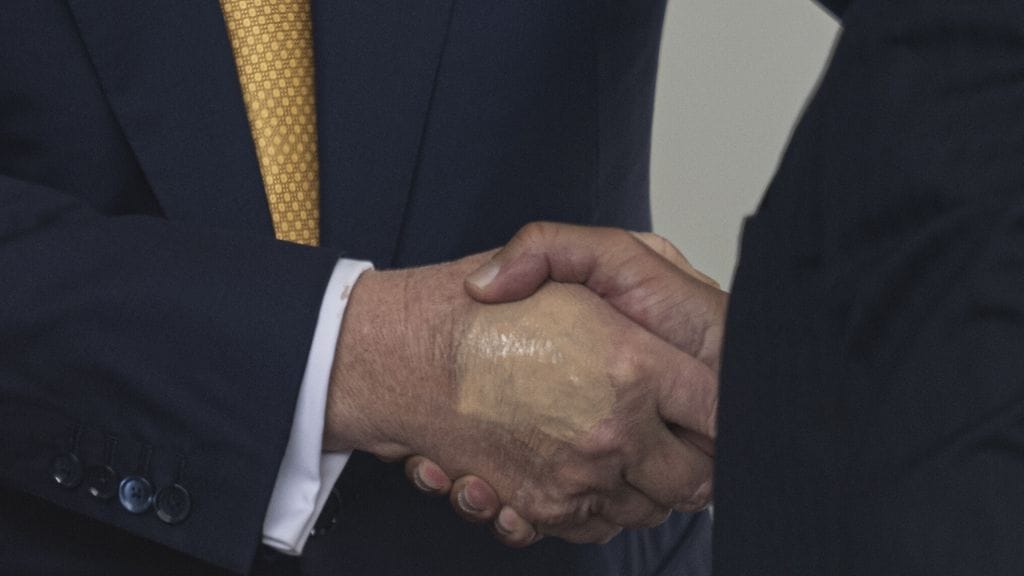 AOP Trumpin käsi 17.7.2025