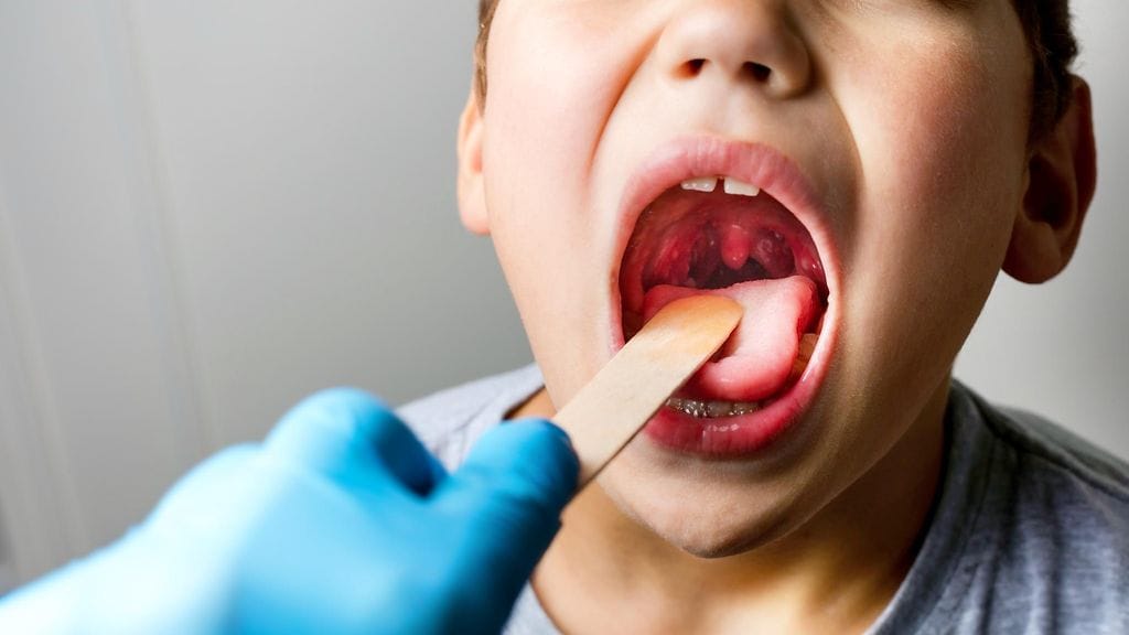 Liian kookkaat nielurisat voivat aiheuttaa esimerkiki uniapneaa tai kuorsausta. Kuvituskuva.