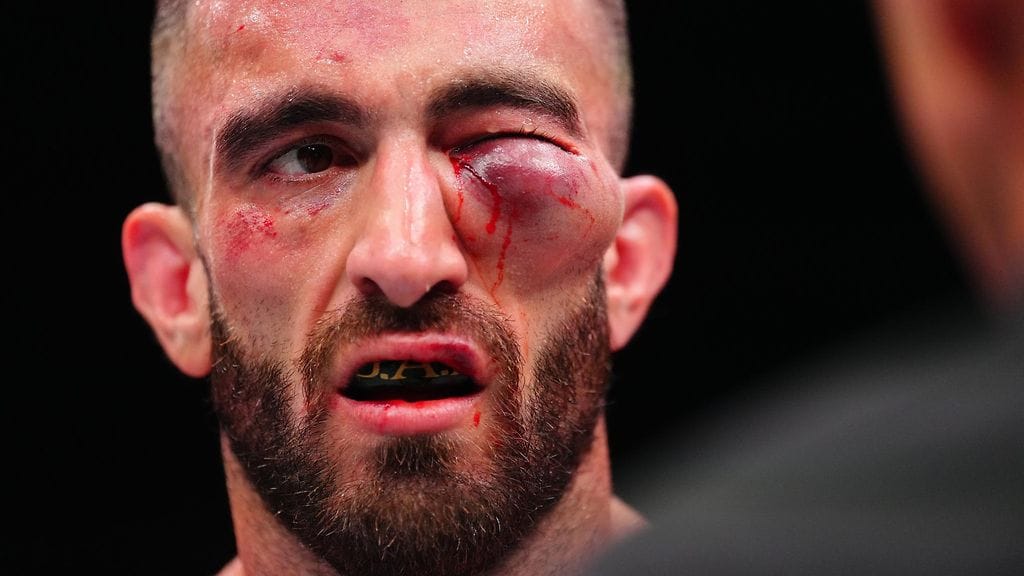 Mohammad Yahyan silmäkulma turposi pahasti.