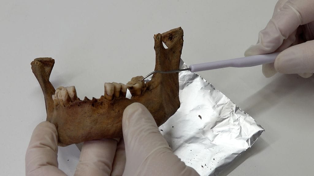 Vapriikki DNA-tutkimus hampaat