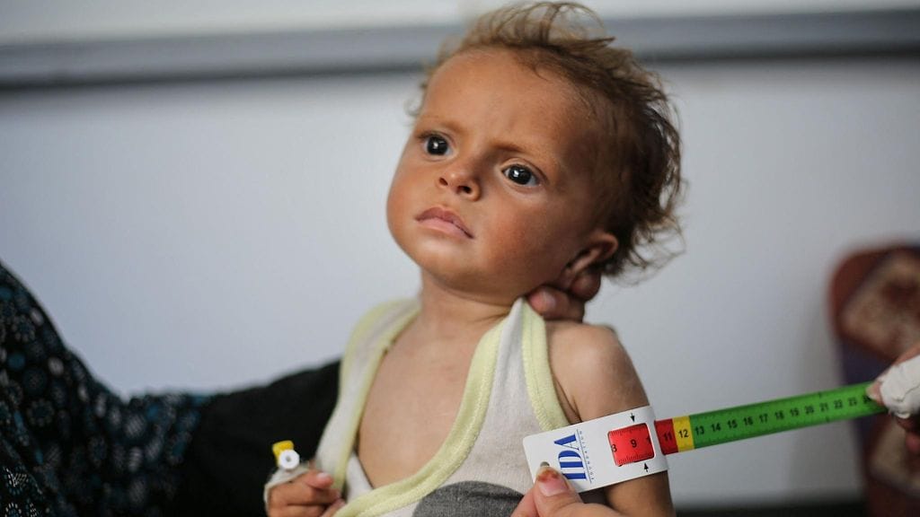 LK0508 Aliravittu lapsi