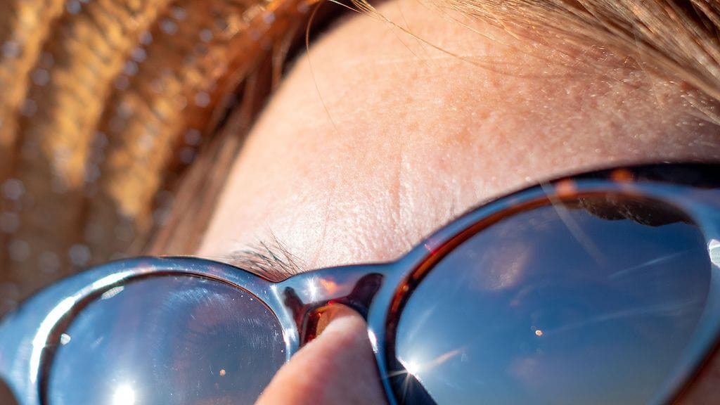 Ihmisen iholla yleisesti esiintyvät beeta-HP-virukset voivat kaapata kehon soluja ja edistää syövän kasvua niissä.