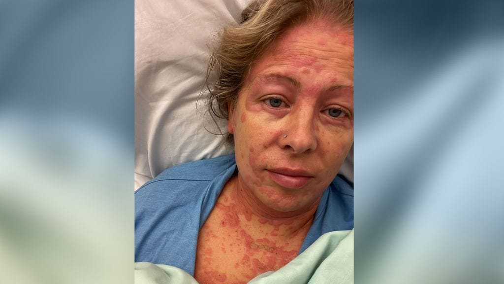 VJ Maria eksoottiset taudit