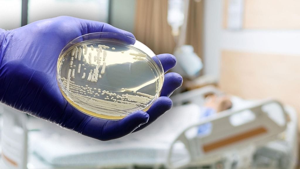 C. auris aiheuttaa vakavia yleisinfektioita. Kuvituskuva.