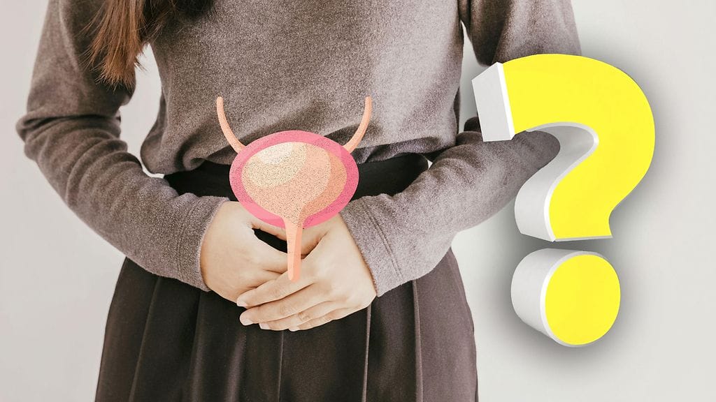 Virtsarakko on lihassäkki, joka venyy.