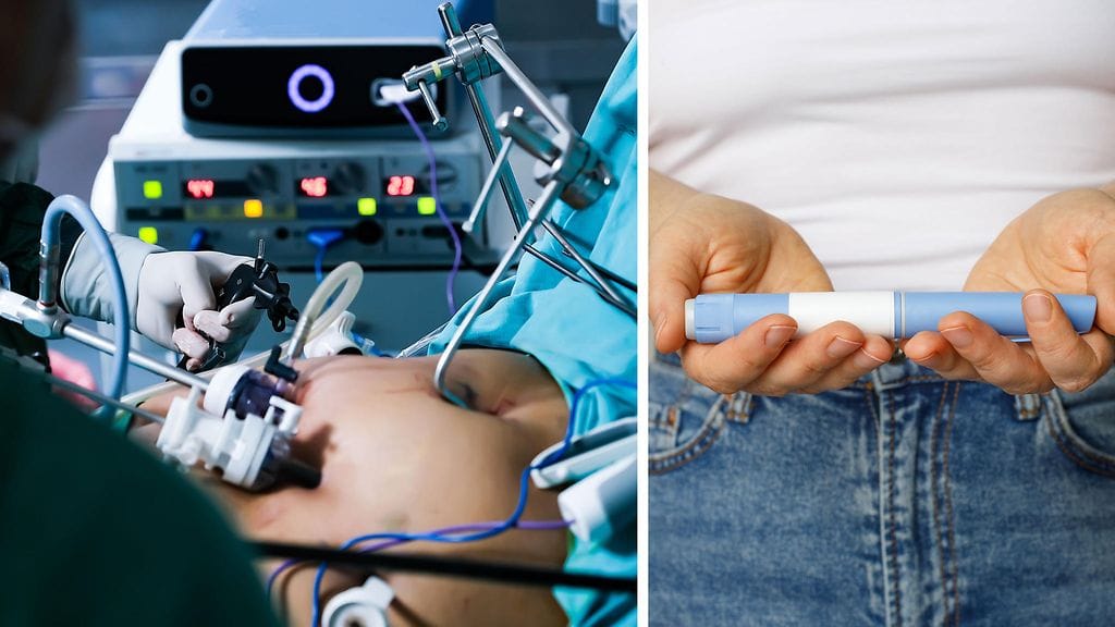 Selvityksessä vertailtiin tietoja henkilöiltä, jotka olivat käyttäneet painonhallintapistosta, ja henkilöiltä, jotka olivat käyneet lihavuusleikkauksessa.