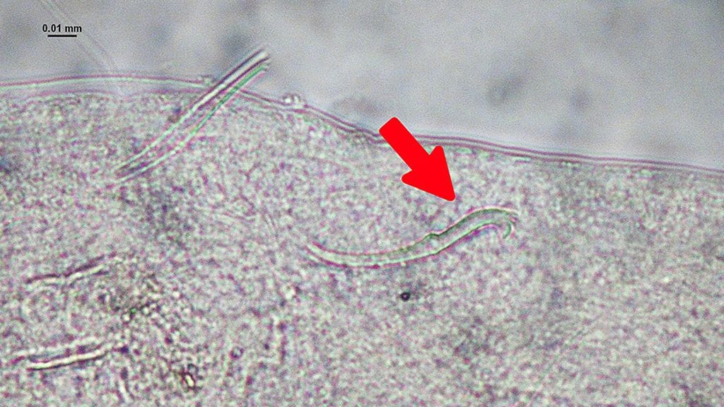 Suomelle uusi harvasukasmatolaji Vejdovskyella intermedia löytyi Kymijoesta Mäkikylän puhdistamon alapuoliselta näytepaikalta liejupohjalta. Kuvassa mikroskooppikuva lähikuva erikoisen mallisesta ventraalisukasesta.