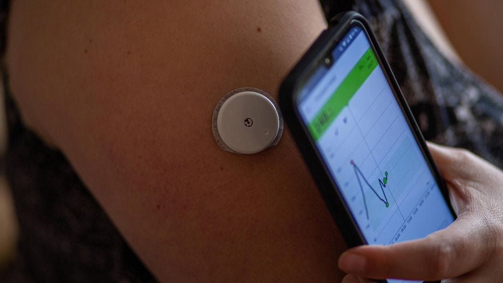 Abbottin glukoosisensoreiden toimivuus kannattaa tarkistaa.