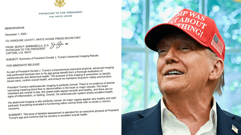 79-vuotiaan Trumpin terveydestä on puhuttu julkisuudessa usein.