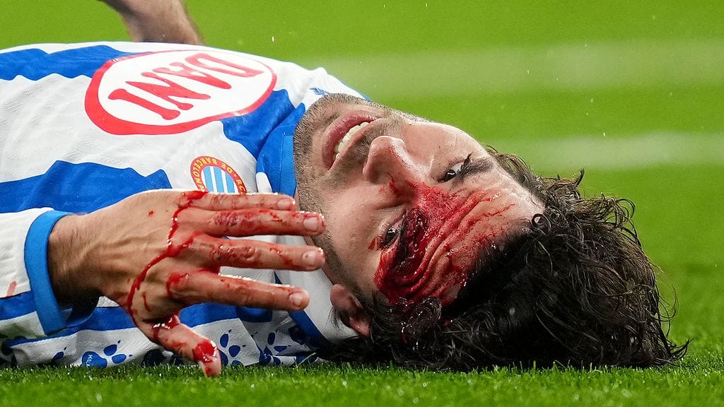 GettyImages-2254519119