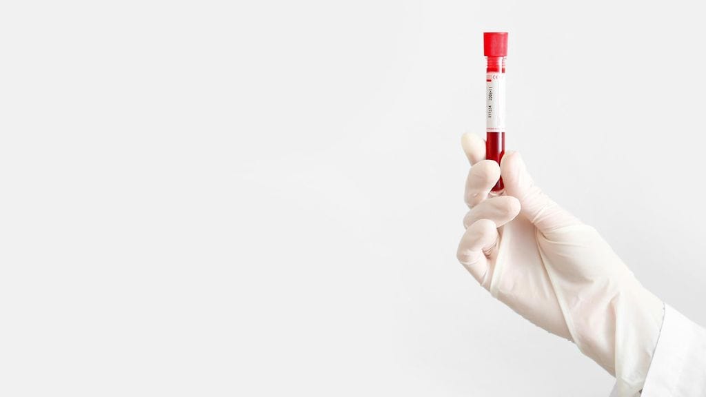 Elimistön rauta-arvot todetaan verikokeilla.