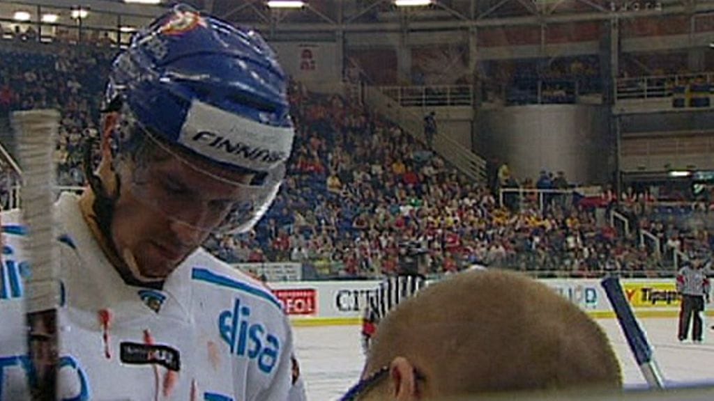 Sami Lepistö paita verisenä