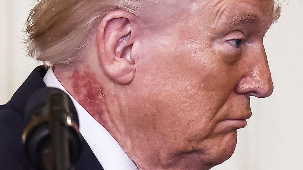 AOP Trump kaula 2 030326