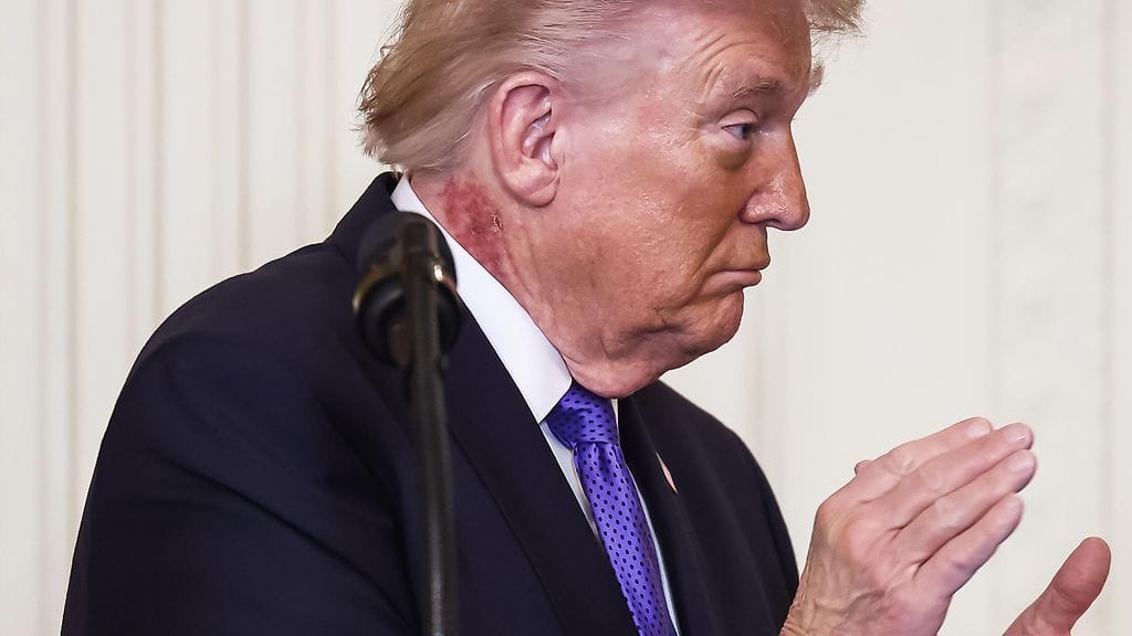 AOP trump ihottuma 2025