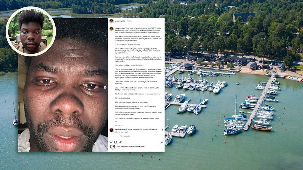 Vincent Vainio kertoi pahoinpitelystä tuoreeltaan Instagramissa. Kuva: Vincent Vainio ja AOP.