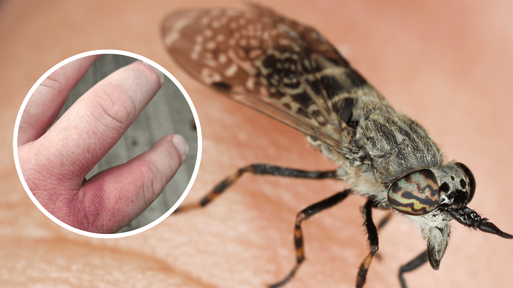 Espoolainen Anders sai paarman puremasta borrelioosin.