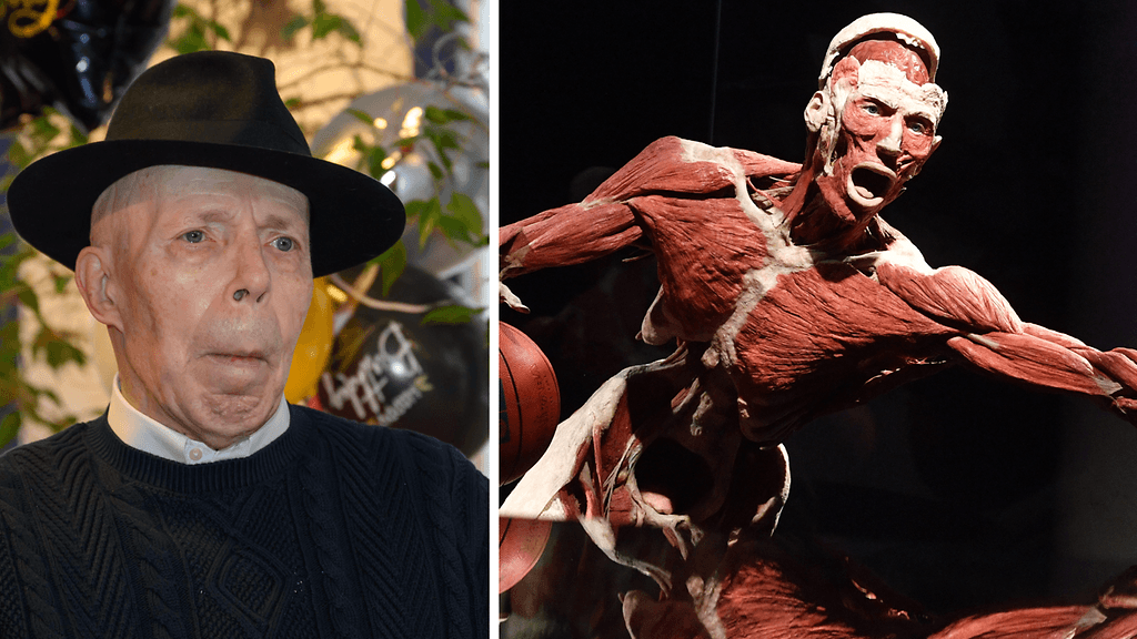 Gunther Von Hagens kehitti niin sanotun plastinointi-menetelmän, jolla ruumiin elimistön kudosten neste korvataan hartseilla ja silikonikumilla.