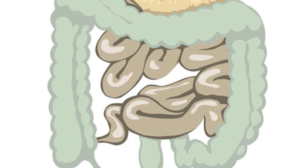 Suolihuuhtelussa pyritään saamaan jätteet pois suolistosta.