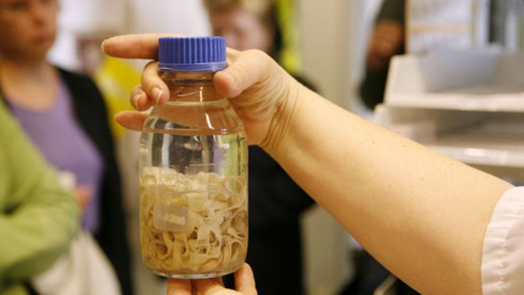 Epätoivoiset ovat kokeilleet jopa lapamatodieettiä. Kuvassa Haartman-instituutin bakterologian osastolla säilytetty lapamato.