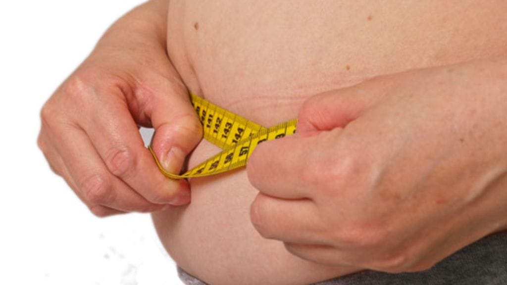 Pääsisitkö sinä lihavuusleikkaukseen?