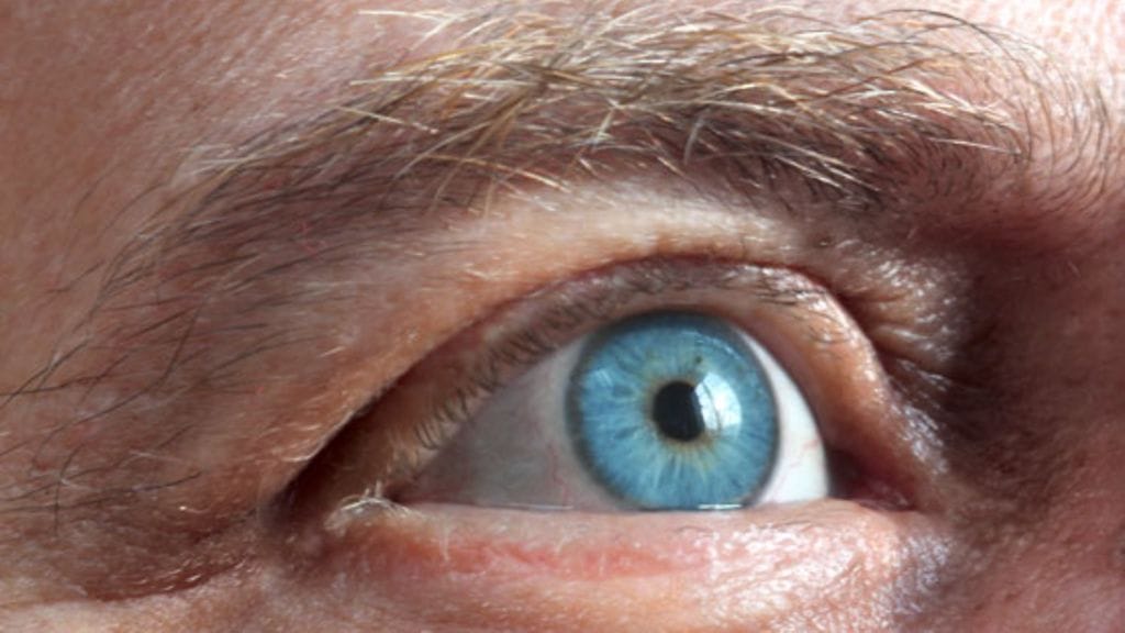 Elohiirtä voi hoitaa lääkkeillä, mutta sitä vältetään.