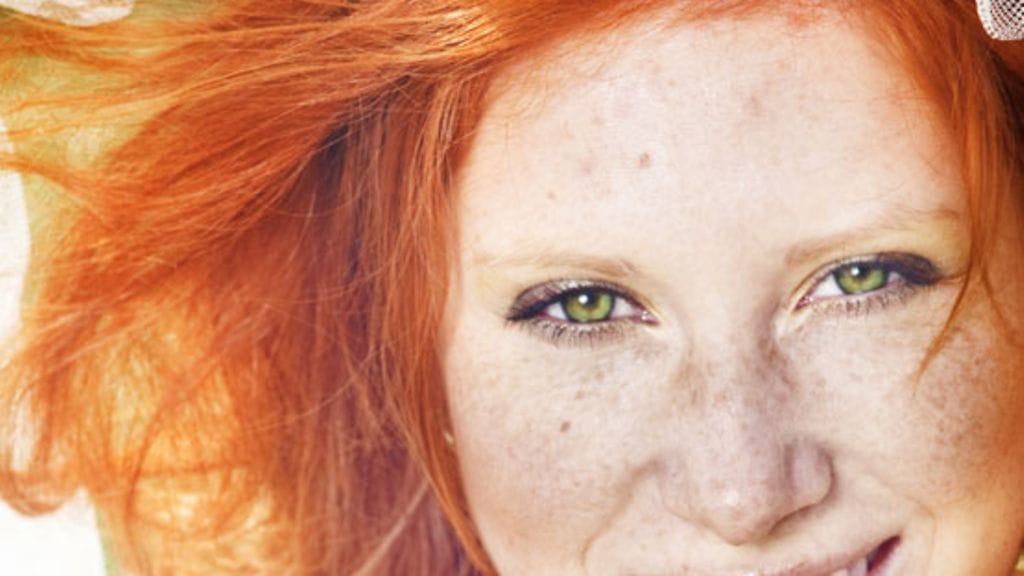 Punatukkaisten ja pisamakasvoisten ei ole turvallista ottaa aurinkoa.