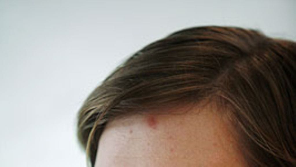 Janne Ahonen, kuva: Timo Jaakonaho / Lehtikuva