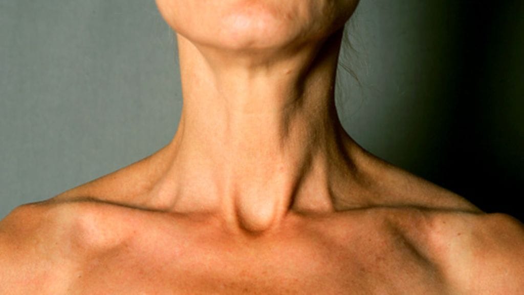 Kuva: Lehtikuva/Antti Aimo-Koivisto