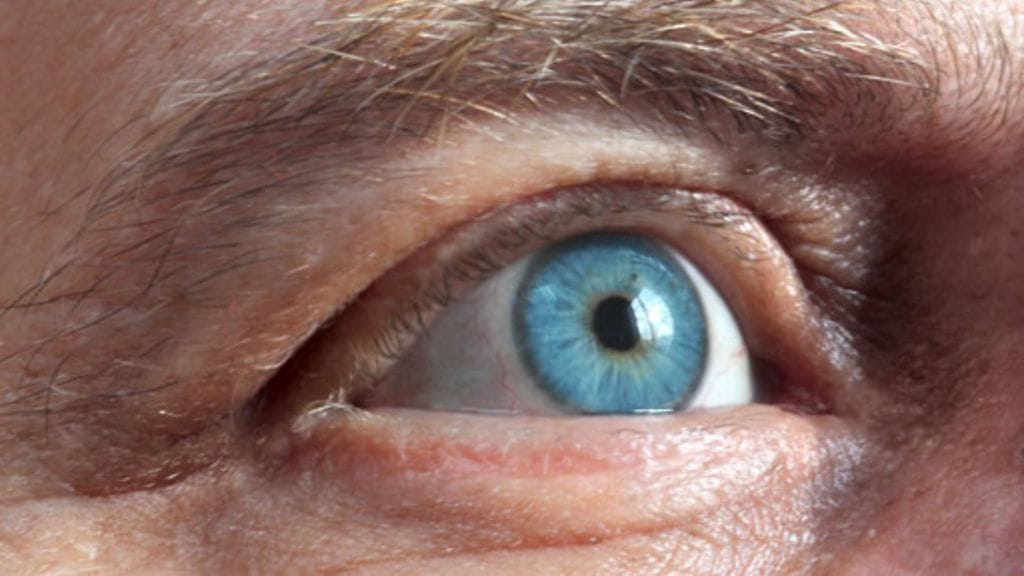 Aisteja voi menettää äkillisesti - vaikka se onkin harvinaista. Kuvituskuva.