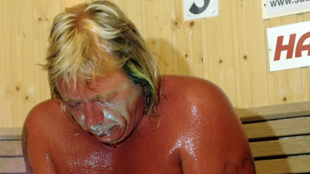 Pahat palovammat saaneen Timo Kaukosen ihonsiirtoleikkaus peruttiin, kun häntä oli hoidettu kiinalaisen lääketieteen keinoin.